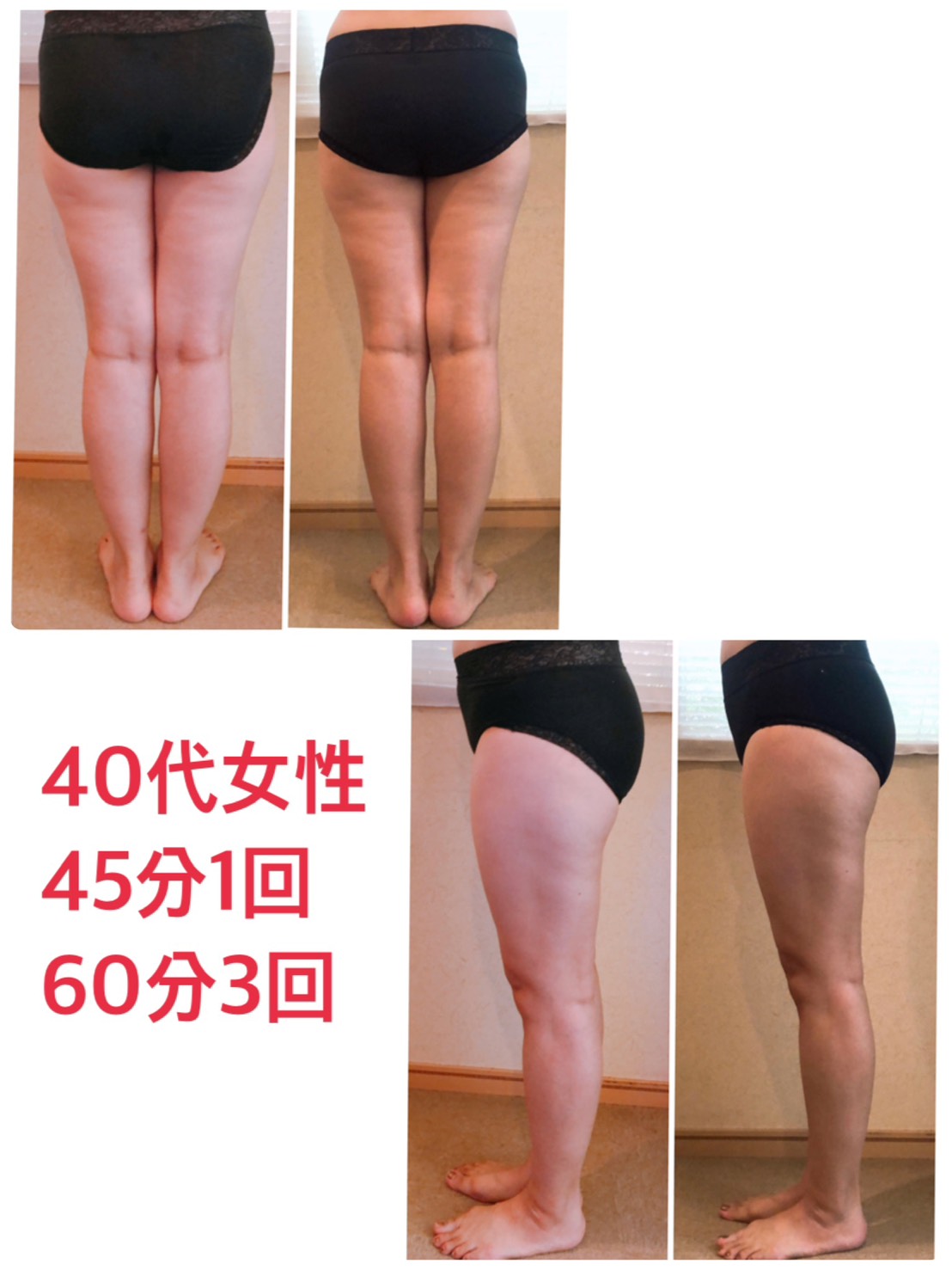 テスラスカルプト
